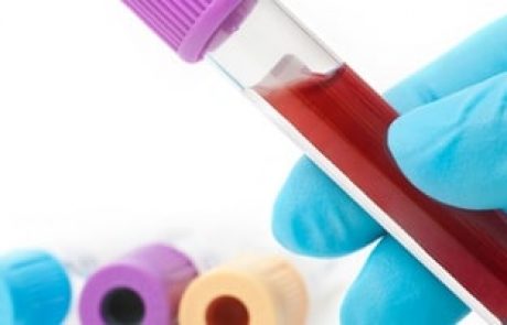 PMS תסמונת קדם וסתית וכאבי מחזור