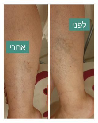 ורידים