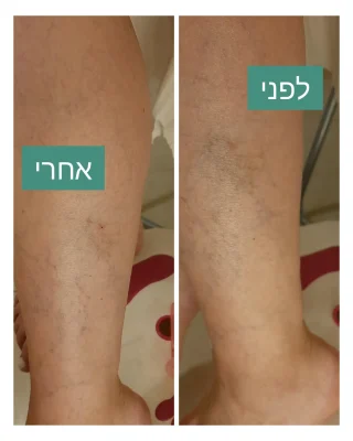 ורידים