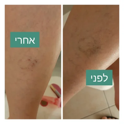 ורידים